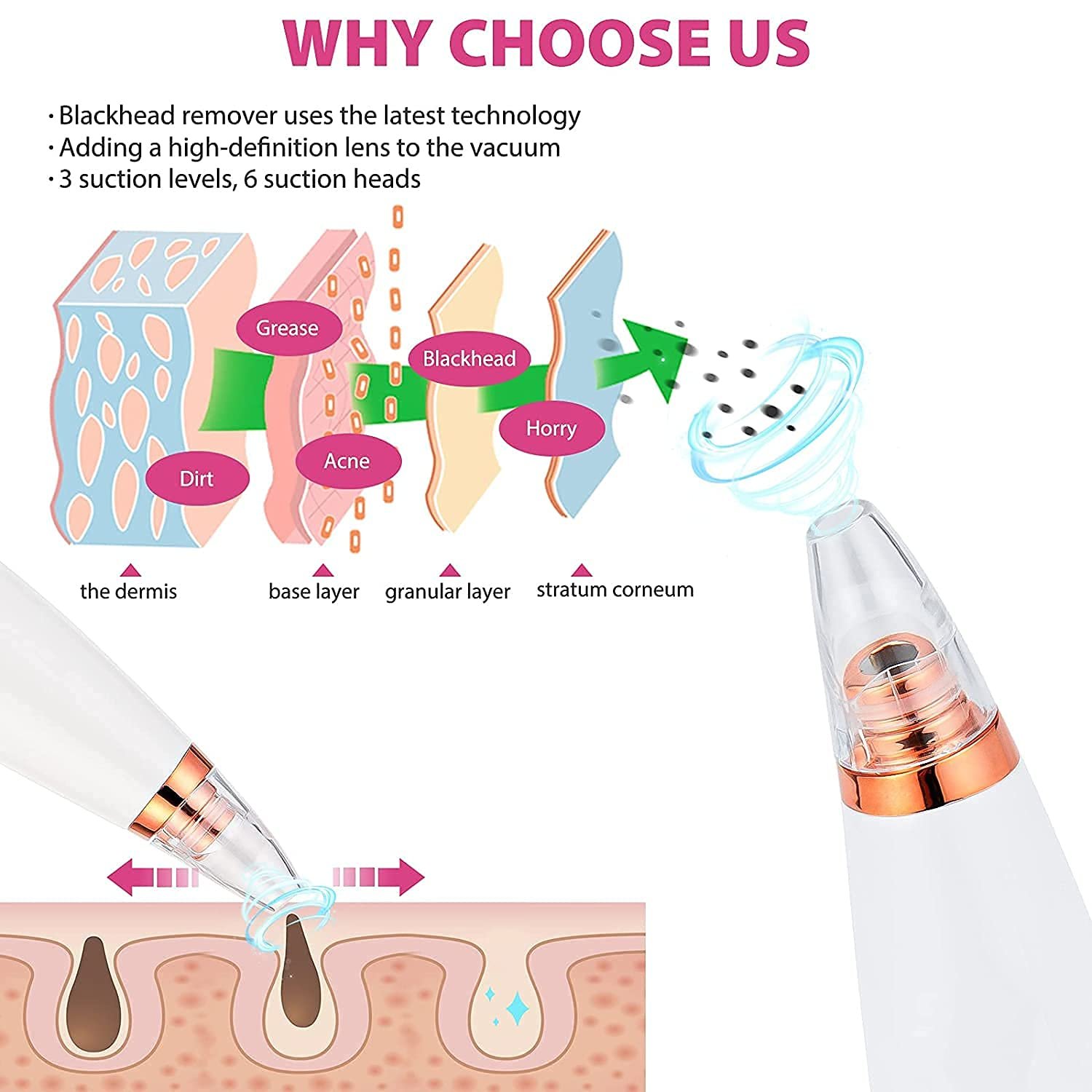 Features of derma suction
